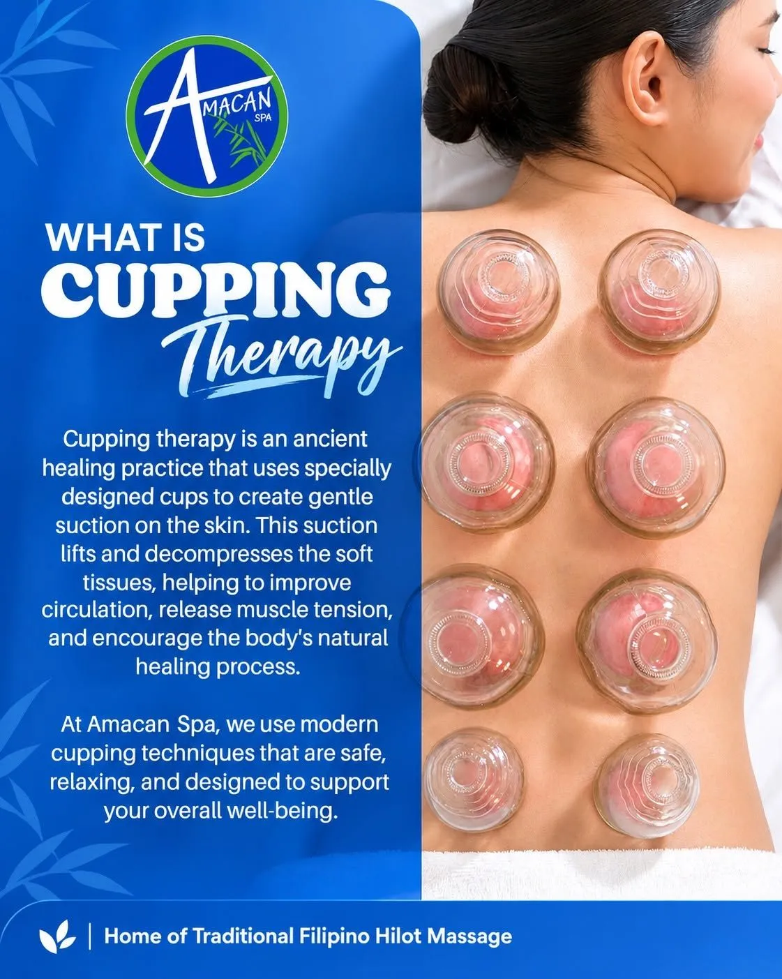 Amacan Spa Facebook post: Ventosa cupping
